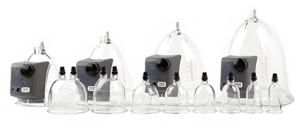 cupping-therapy-plus-wonderpoint-wellness-centre-burnaby-bc
